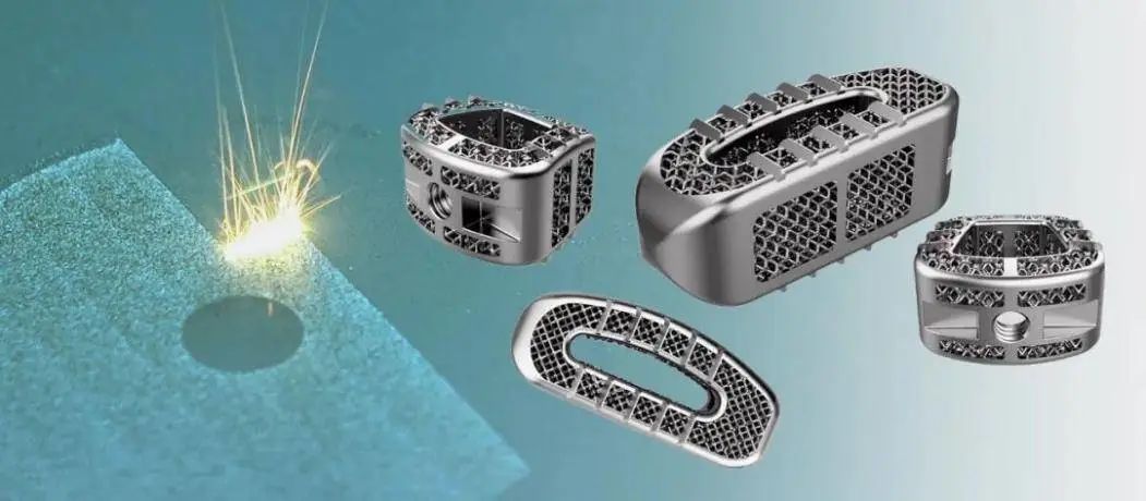 從術前導航到體內植入 醫療3D打印的十年跨越與衡器制造技術